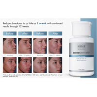 Obagi CLENZIderm M.D.® Pore Therapy