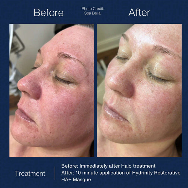 Hydrinity Restorative HA+ Masque