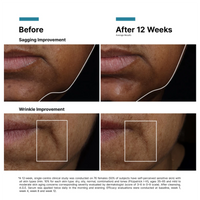 SkinCeuticals AGE Interrupter Ultra Serum