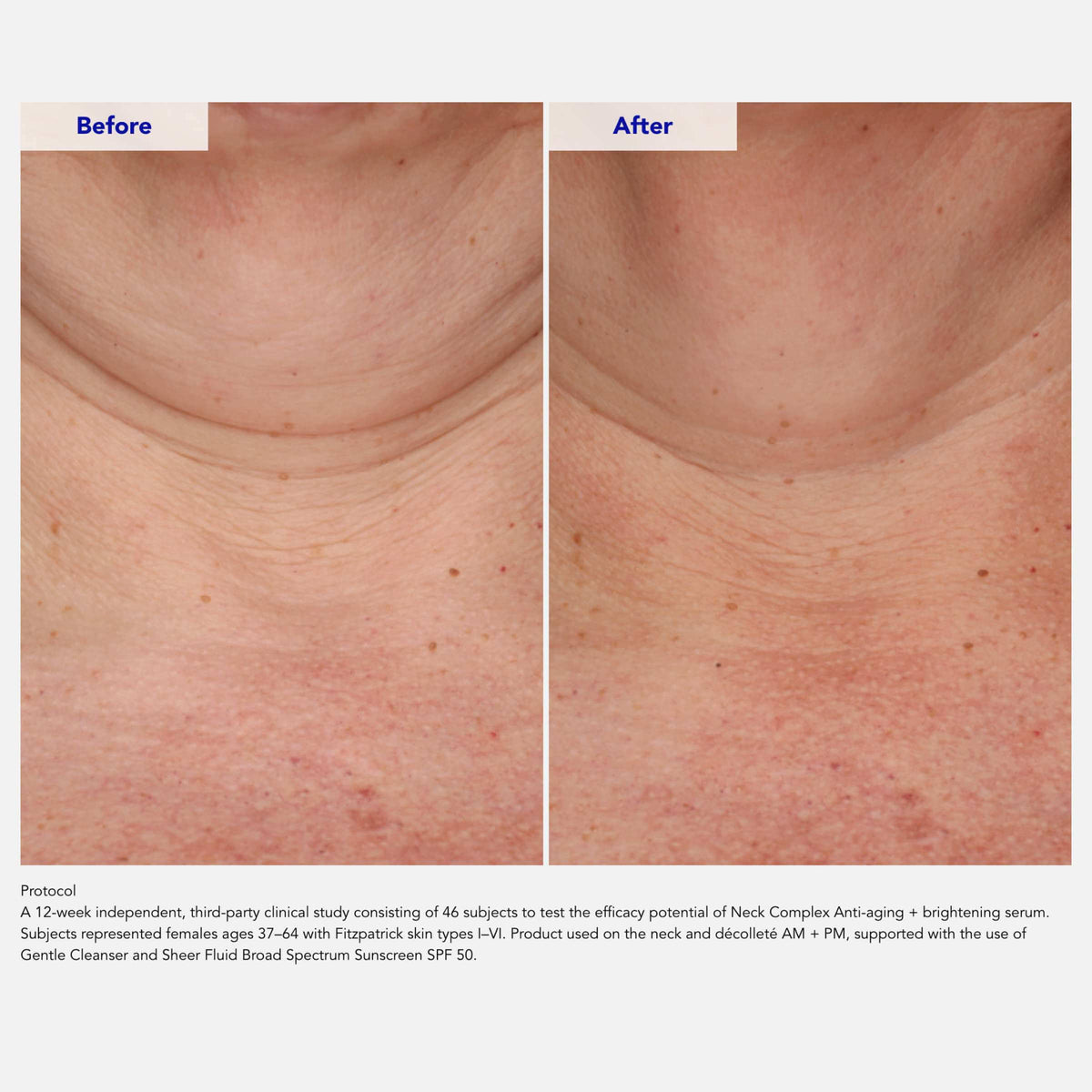 ZO Skin Health Neck Complex Anti-Aging + Brightening Serum