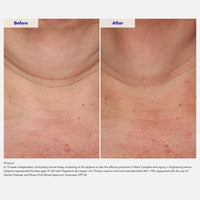 ZO Skin Health Neck Complex Anti-Aging + Brightening Serum