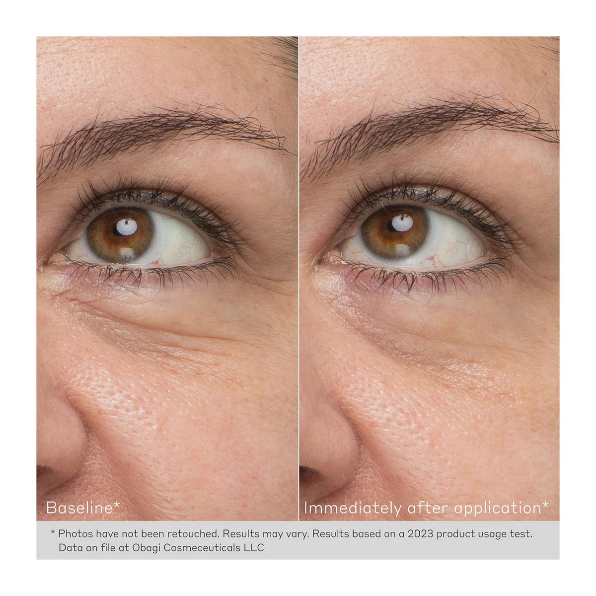 Obagi Daily Hydro Drops Rejuvenating Eye Gel Cream