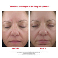 Obagi360® Smoothing Retinol 0.5