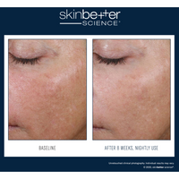 SkinBetter Alto Advanced Defense and Repair Serum