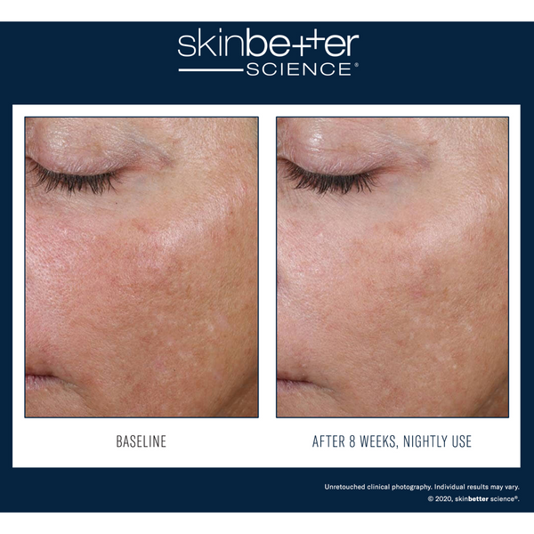 SkinBetter Alto Advanced Defense and Repair Serum