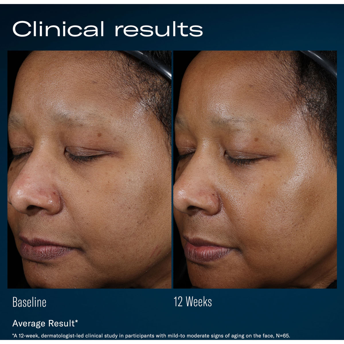 SkinBetter Science Ampra Volumizing Macro HA Serum