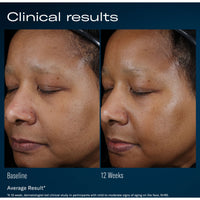 SkinBetter Science Ampra Volumizing Macro HA Serum