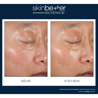 SkinBetter Alto Defense AlphaRet Duo Kit