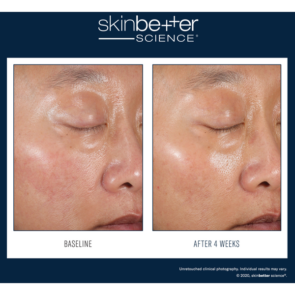 SkinBetter Alto Defense AlphaRet Duo Kit