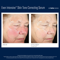 SkinBetter Even Intensive Skin Tone Correcting Serum