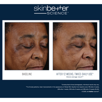 SkinBetter Mystro Active Balance Serum