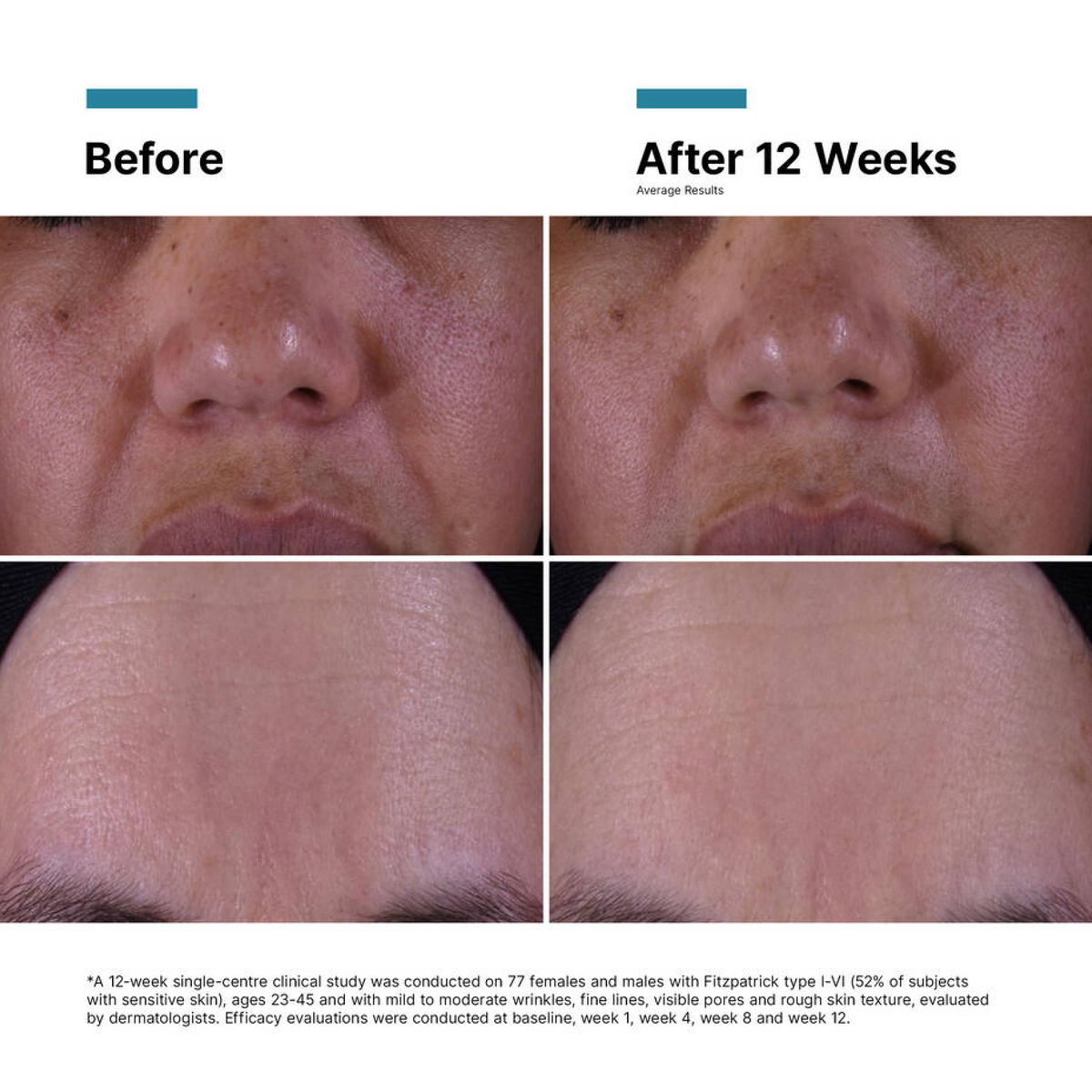 SkinCeuticals P-TIOX Anti-Wrinkle Cream