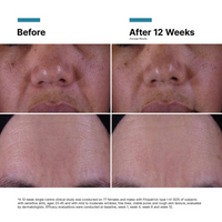 SkinCeuticals P-TIOX Anti-Wrinkle Cream - Travel Size