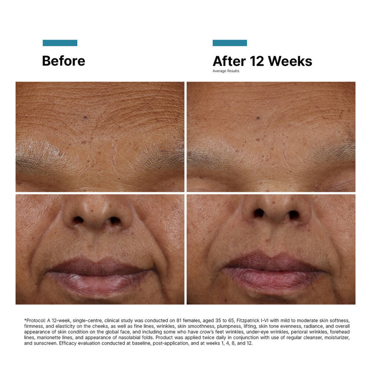SkinCeuticals H.A. Intensifier