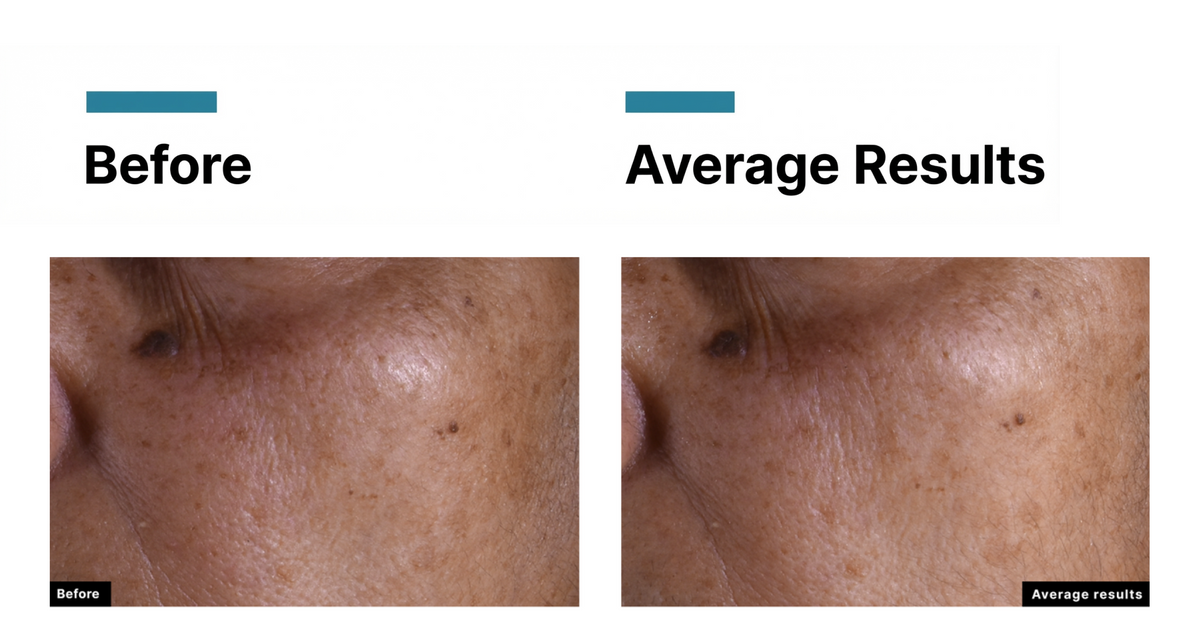 SkinCeuticals C E Ferulic — New 2026 Formula