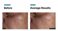 SkinCeuticals C E Ferulic — New 2026 Formula