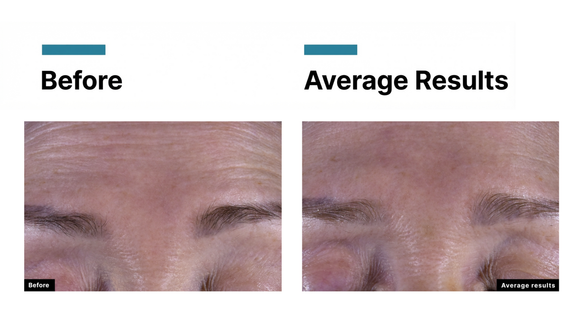 SkinCeuticals C E Ferulic — New 2026 Formula