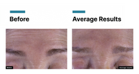 SkinCeuticals C E Ferulic — New 2026 Formula
