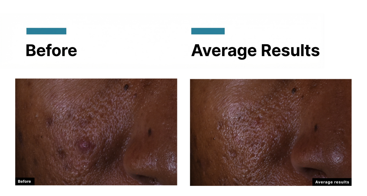 SkinCeuticals C E Ferulic — New 2026 Formula