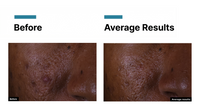 SkinCeuticals C E Ferulic — New 2026 Formula
