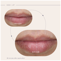 Teoxane [3D] Lip, Nourishing & Plumping Lip Care