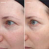 Colorescience Total Eye® Firm & Repair Cream