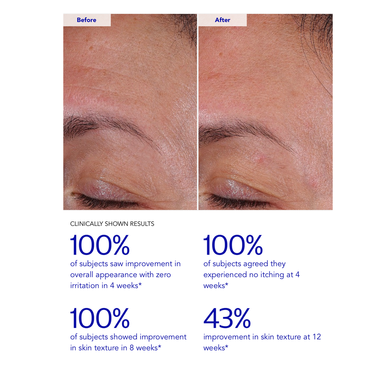 ZO Skin Health Wrinkle + Texture 0.3