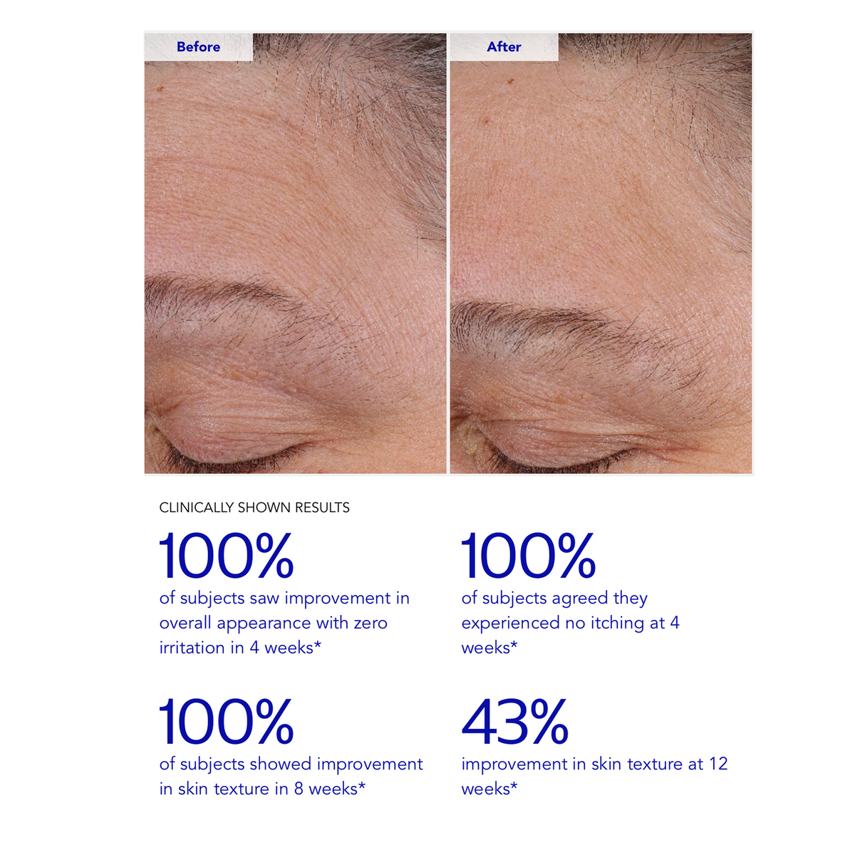 ZO Skin Health Wrinkle + Texture 0.3