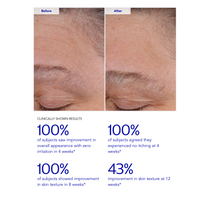 ZO Skin Health Wrinkle + Texture 0.3