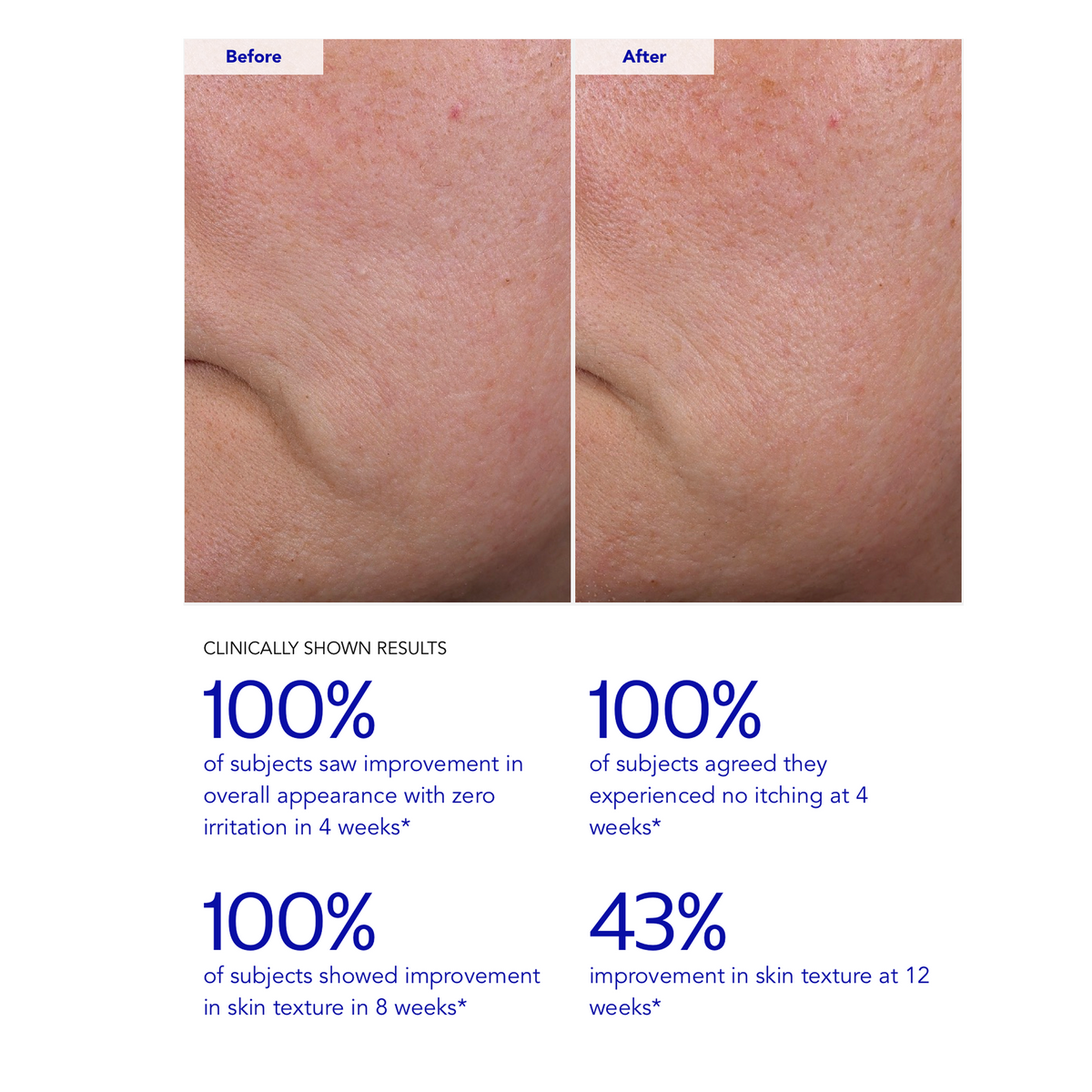 ZO Skin Health Wrinkle + Texture 0.3
