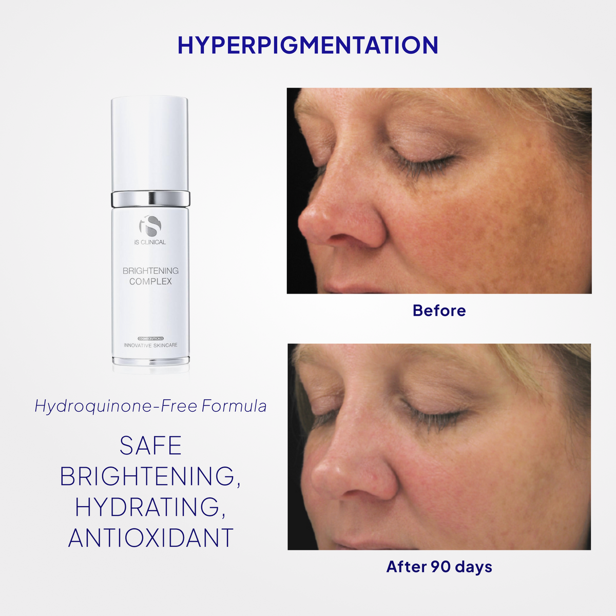 iS Clinical Brightening Complex