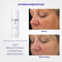iS Clinical Brightening Complex