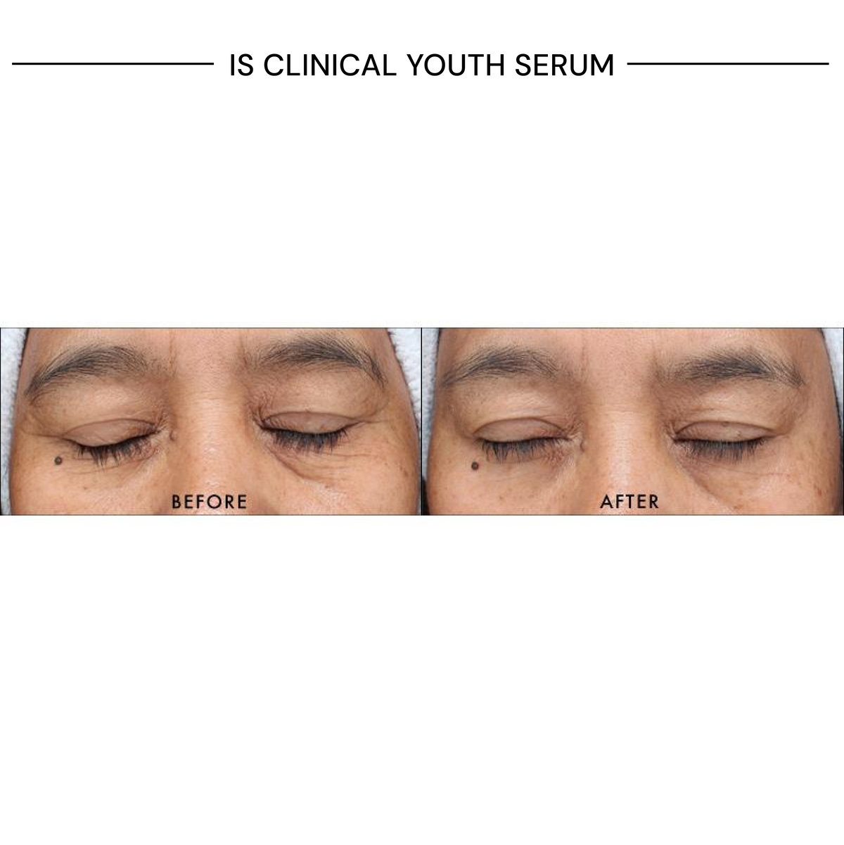 iS Clinical Youth Serum