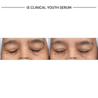 iS Clinical Youth Serum